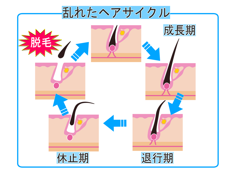 発毛・育毛ラボ　ひろ鍼灸院へ！